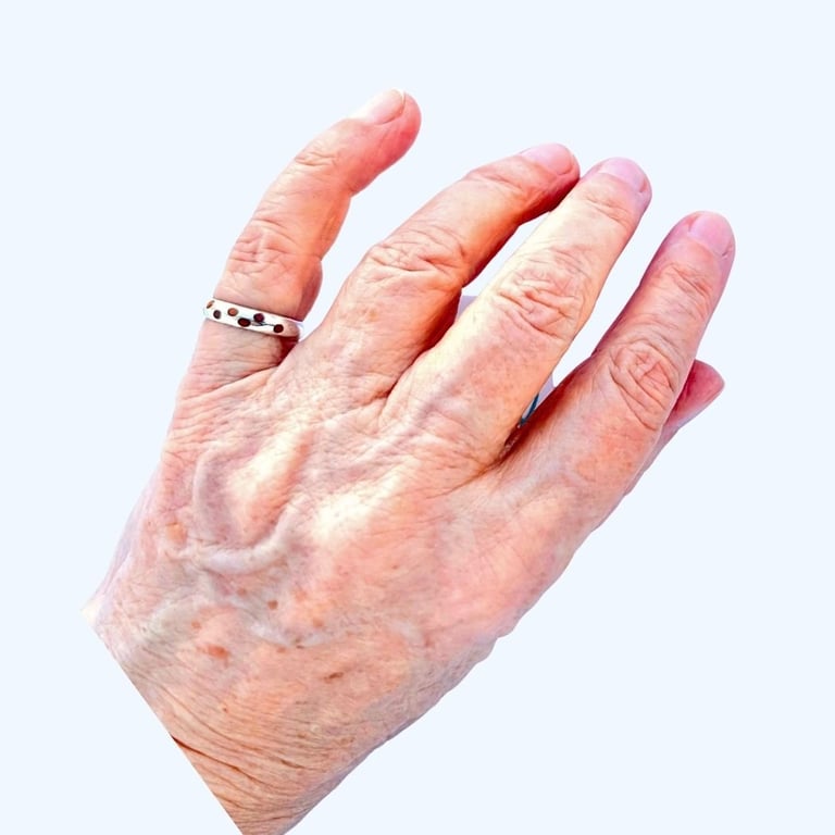 Spotty Ring 2 *** billede 2